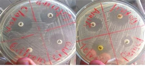 Comparación de actividad in vitro anti Staphylococcus aureus de ocho