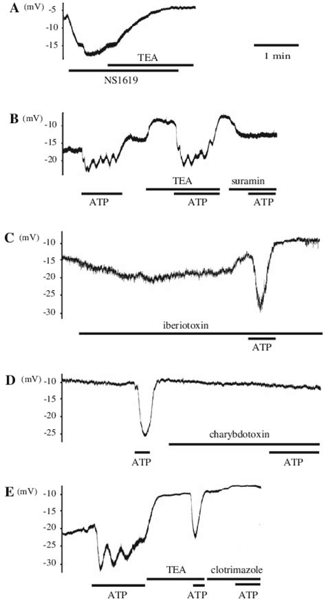 Effects Of Bk And Ik Channel Blockers On Hyperpolarization In Sam