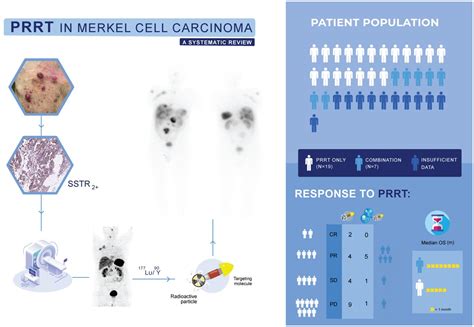 Peptide Receptor Radionuclide Therapy In Merkel Cell Carcinoma A