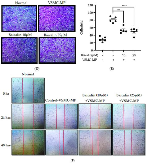 Effect Of Baicalin On Vsmc Mp Induced Vsmc Migration Vsmc Were