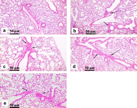 Histopathological Analysis Of Lung Tissue After Exposure To Yb Nps