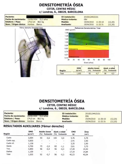 Figure 1 From Efectos Del Tratamiento Con Testosterona En La Densidad Mineral ósea Y La