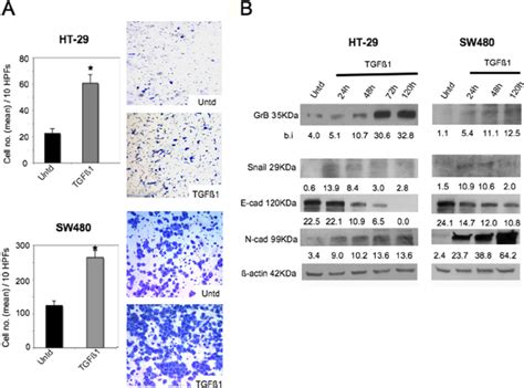 Tgf β 1 Driven Emt Is Associated To Enhancement Of Grb Expression Crc