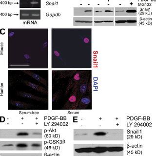 Expression And Regulation Of Snail In Activated Fibroblasts A Mouse