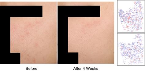 Clinical Images Of Case 1 In Study 3 FSCC As Depicted By A Red Line