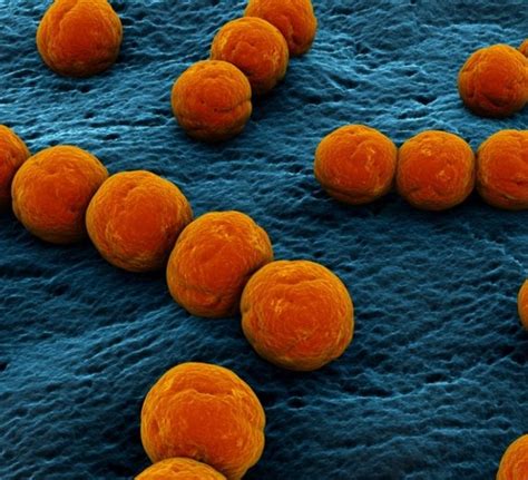 Bacteria Comedora De Carne - Cientistas descobrem tempo de evolução da bactéria 'comedora de carne ...