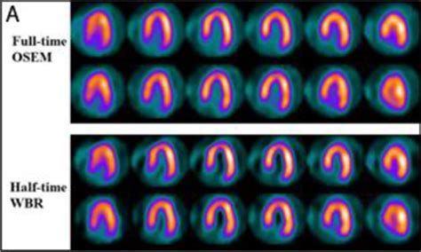 Contemporary Cardiac Spect Imaging—innovations And Best Practices An