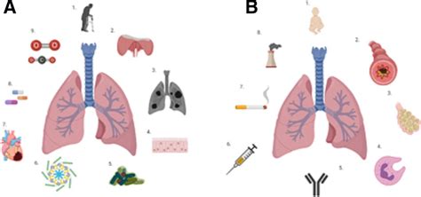 Neutrophils In Community Acquired Pneumonia Parallels In Dysfunction At The Extremes Of Age