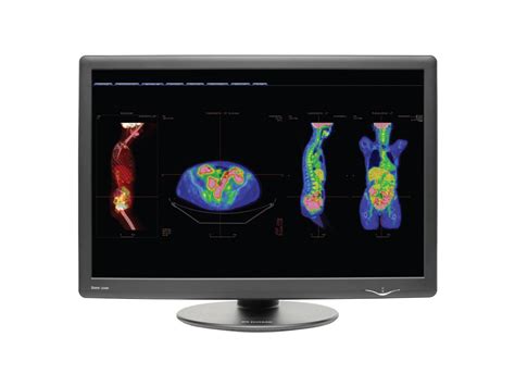 NDS Surgical Imaging Dome GX4MP 30 LCD Monitor 12 Ms Newegg