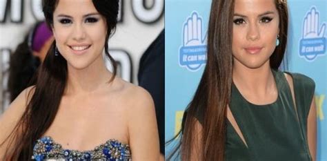 Selena Gomez Plastic Surgery Before And After Rumors