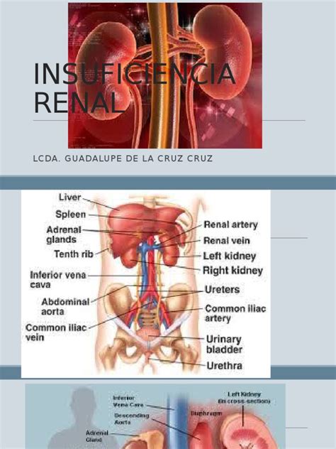 PDF Insuficiencia Renal Aguda 2 DOKUMEN TIPS