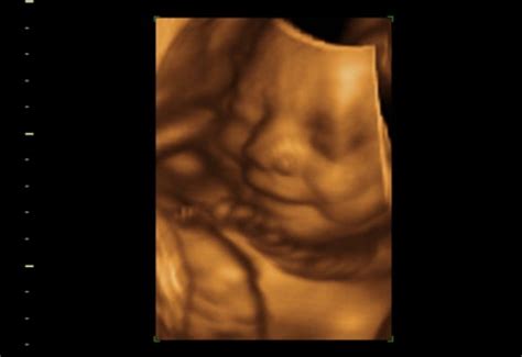 FETAL MEMORIES 2D 3D 4D ULTRASOUND - Updated January 2025 - 146 Photos ...