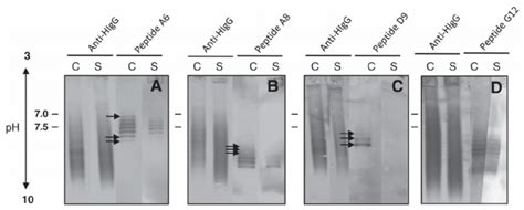 Phage Peptides Recognize Specific CSF Oligoclonal IgG Bands In