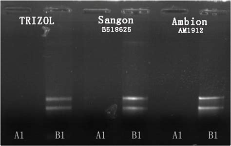 Agarose Gel Electrophoresis Results For Total Rna Extraction From B Download Scientific