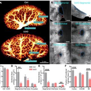 Three Dimensional 3D Reconstruction And Quantification Of Renal