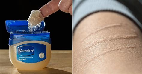 Does Vaseline Help Scars Castor Oil Guide