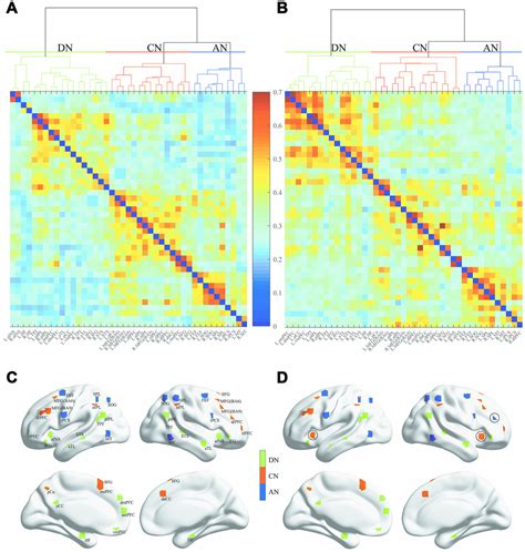 Increased Intrinsic Default Mode Network Activity As A Compensatory