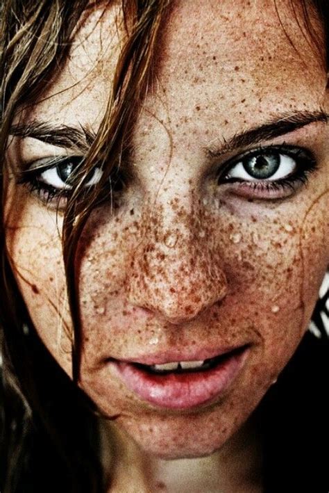 Pin On Freckles