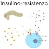 Insulino Resistenza Cause E Sintomi