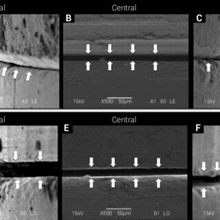 Representative Scanning Electron Microscopy Sem Images Of The