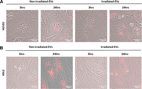 The Uptake Of Hp Msc Derived Evs By Huvec And H C Cells Confocal