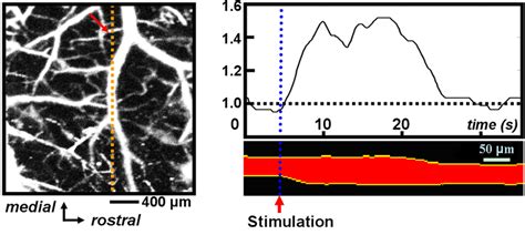 Top Left Transcranial Photoacoustic Imaging Of The Mouse