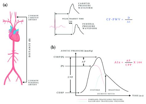 A Aortic Pulse Wave Velocity Measurement With Applanation Tonometry Download Scientific