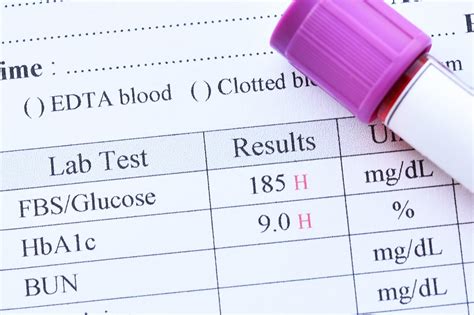 Hyperglycemia May Worsen Outcomes of Intravenous Thrombolysis in ...