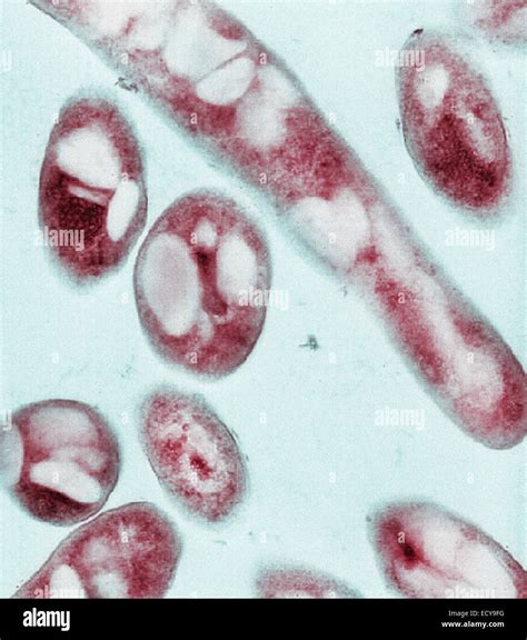 Bacillus Anthracis Micrograph Fotograf As E Im Genes De Alta Resoluci N