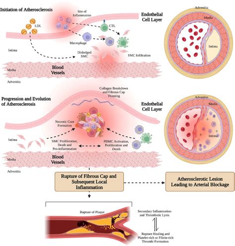 Frontiers Atherosclerosis Treatment With Nanoagent Potential Targets Stimulus Signals And