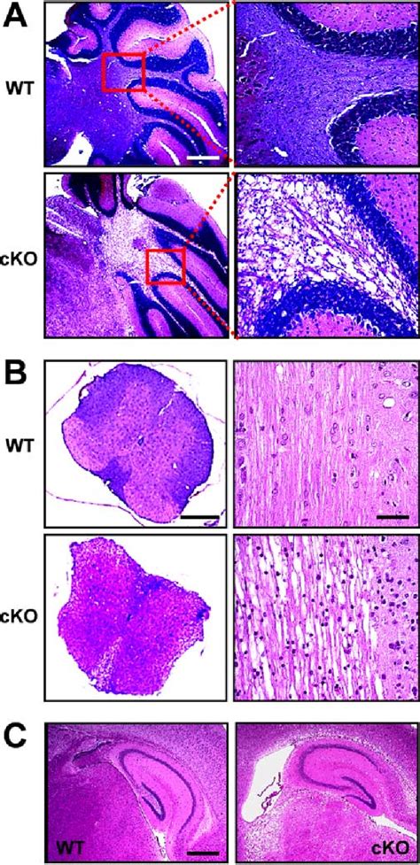 Figure 4 From Conditional Knock Out Of Kir4 1 Leads To Glial Membrane