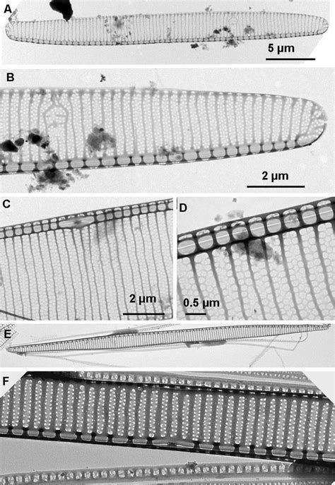 Tem Micrographs Of Pseudo Nitzschia Species From Helgoland Roads Ab