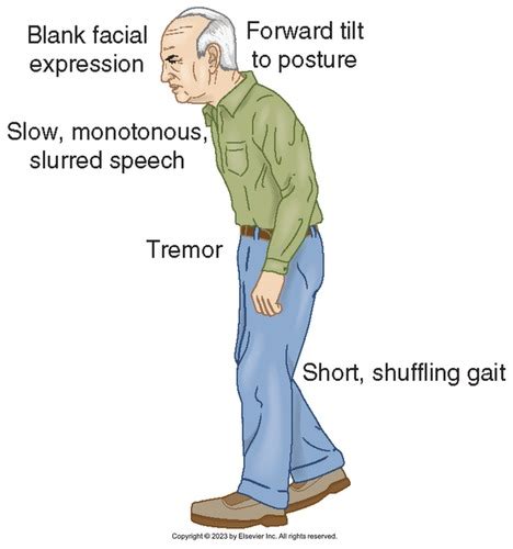 Parkinsons Disease Flashcards Quizlet