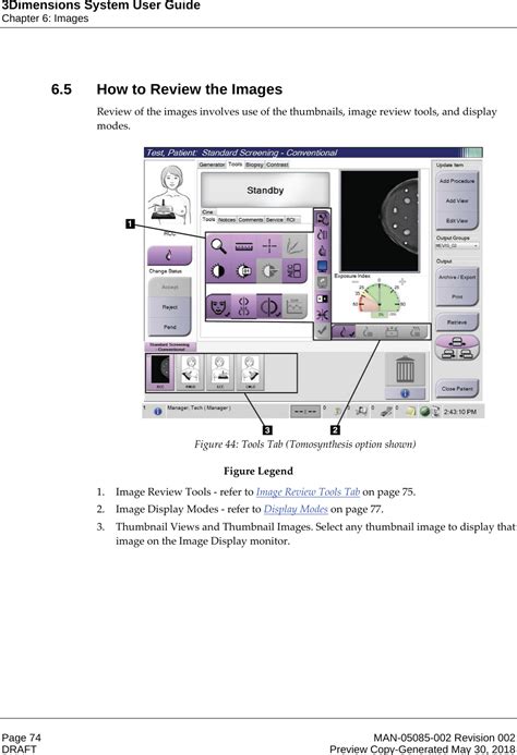 Hologic Pcb Rfid Interface Board For Selenia Dimensions