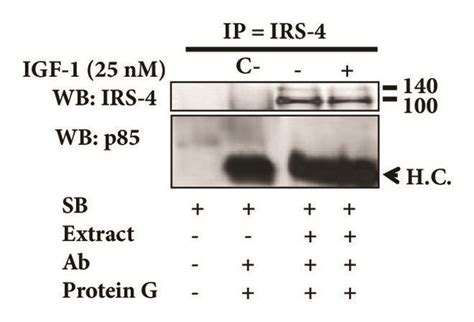 A Rko Cells Stable Transfected With Pcdna Irs Or Pcdna Were