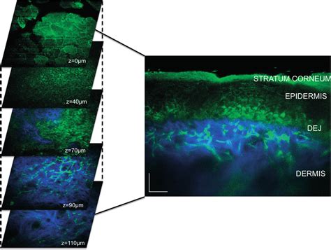 2 In Vivo MPM Imaging Of Normal Skin Volar Forearm Left MPM