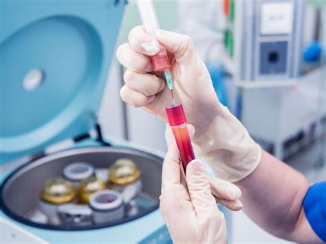 Platelet Rich Plasma PRP And Knee Pain