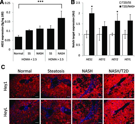 Notch Dependent Gene Expression Is Progressively Increased In Insulin