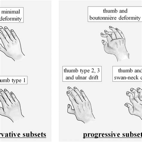 Thumb Alterations In Patients With Rheumatoid Arthritis Progression Of