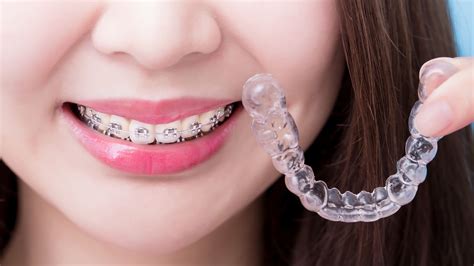 Invisalign Aligners Have Benefits Over Traditional Braces Clearpath Orthodontics