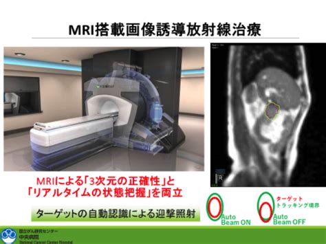 第29回 日本定位放射線治療学会 アフタヌーンセミナー4 ご参加の御礼 新着情報 Viewray ビューレイ 放射線外部照射機