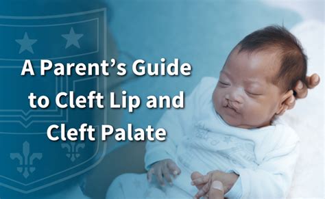 A Parents Guide To Cleft Lip And Cleft Palate Department Of Surgery