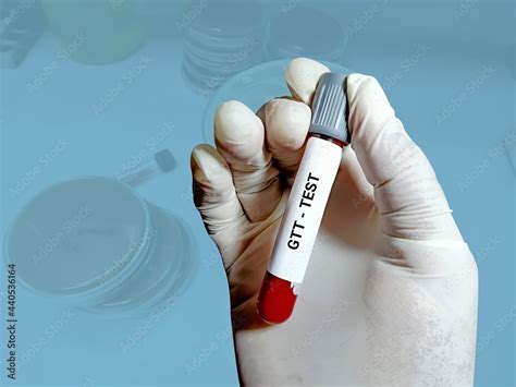 Biochemist Or Lab Technologist Holds Blood Samples Glucose Tolerance