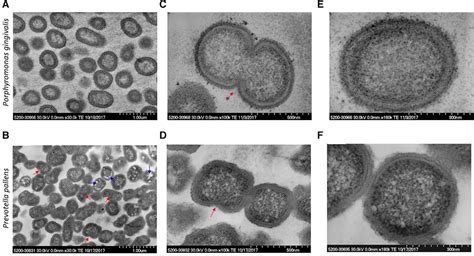 Frontiers Stannous Fluoride Forms Aggregates Between Outer And Inner