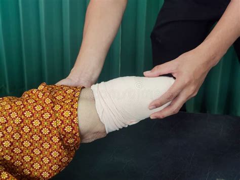 Below Knee Amputation Bandaging For Bk Prosthesis Stock Image Image