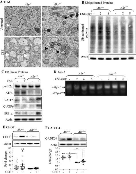 Aryl Hydrocarbon Receptor Ahr Deficiency Causes Endoplasmic Reticulum