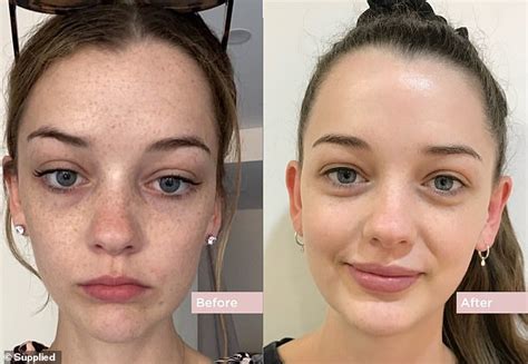 How To Have Flawless Skin At Every Age Skincare Tips In Your 20s 30s