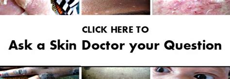 Forehead Acne Causes And Treatment Skin Specialists Online