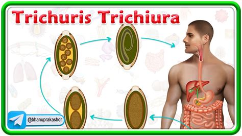 Trichuris Trichiura Microbiology Animation Lifecycle And Trichuriasis Youtube