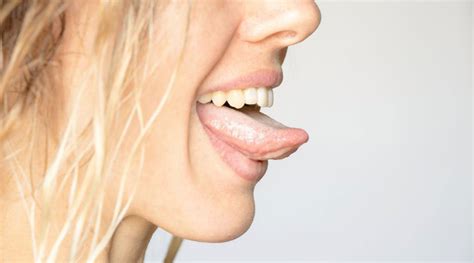 Do You Have a Coated Tongue? Treatment Revealed | by Gnancy Jebadurai ...